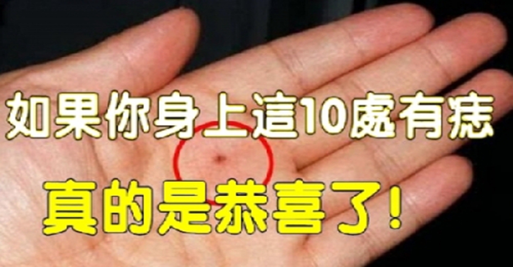 看看你身上「10處有痣」嗎？只要有一個，今生註定發達！